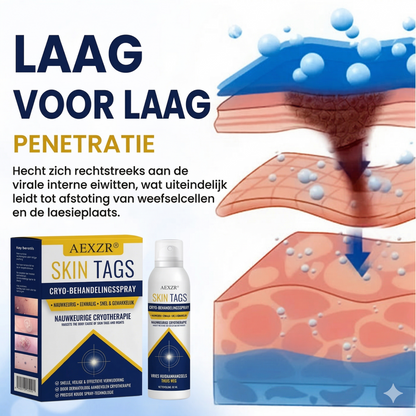 AEXZR ® Cryotherapie Spray voor Wratten en Skin Tags: Verwijder wratten en steelwratjes snel en pijnloos – resultaat binnen 7 dagen! 🚀