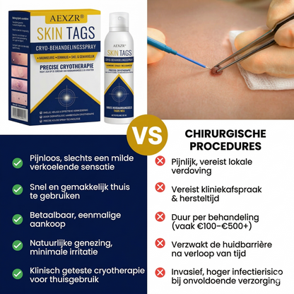 AEXZR ® Cryotherapie Spray voor Wratten en Skin Tags: Verwijder wratten en steelwratjes snel en pijnloos – resultaat binnen 7 dagen! 🚀